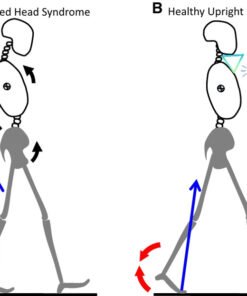 adjustable neck brace